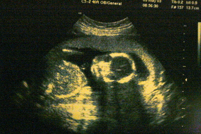 Ziemeļīrija dekriminalizē abortus un legalizē viendzimuma laulības